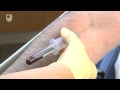 Taking A Blood Sample - Diabetes Care (6/6)