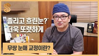 무쌍눈매교정이란 무엇인가요?