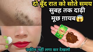 दाढ़ी,मूंछ की ग्रोथ कैसा भी हो😱रात को इसे लगा लो🤔|| facial hair treatment in(Hindi)