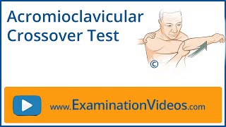 Acromioclavicular Crossover Test