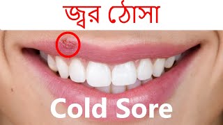 Cold Sore | জ্বর ঠোসা কেন হয় | Herpes simplex Virus | হারপিস সিমপ্লেক্স ভাইরাস | চিকিৎসা ও প্রতিকার