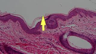 0905 Demo (Episode1) Integumentary System for M115