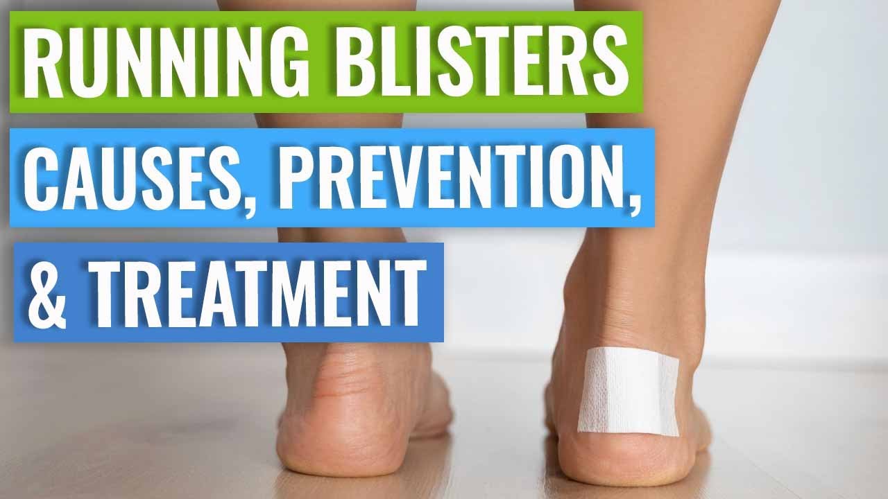 Running Blisters - How To Prevent Blisters Running, What Causes Them ...