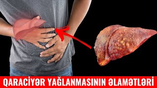 Qaraciyər yağlanmasına nə fayda edər?