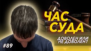 ПЕРЕСАДКА ВОЛОС ДО и ПОСЛЕ, ОТЗЫВ ПАЦИЕНТА #89