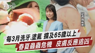 每3月洗牙.塗氟 擴及65歲以上 春夏蟲蟲危機  皮膚反應追凶【TVBS說新聞】20230501@TVBSNEWS02