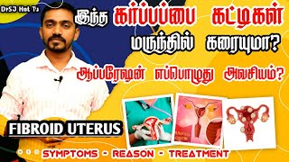 கர்ப்பப்பை கட்டிகளை கரைக்க முடியுமா? இது கேன்சராக மாறுமா? | ALL ABOUT FIBROID UTERUS | DrSJ