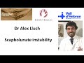 Scapholunate instability by Dr Alex Lluch