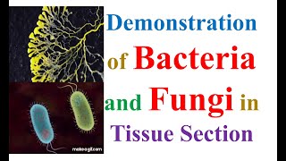 #Demonstration of #Bacteria \u0026 #Fungi in Tissue Section #BMLS #bmlt_lecture #Science #Histotechnology