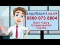 Burn Injury Compensation Claims - Why Choose Legal Expert?