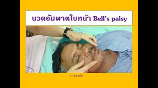 กายภาพบำบัดนวดกระตุ้นอัมพาตใบหน้า Bell’s palsy