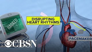 FDA looks into the risk of medical devices being hacked