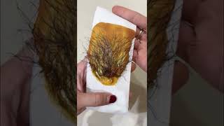 Waxing Armpit Hair 😱 #shorts #hairremoval #armpitwaxing