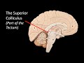 anatomy of the brain model virtual practical exam flash cards