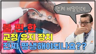 불편한 치아 교정기 정말 평생 하실건가요..❓❓ ㅣ 정확한 교정 유지 장치 기간 확인하세요❗️