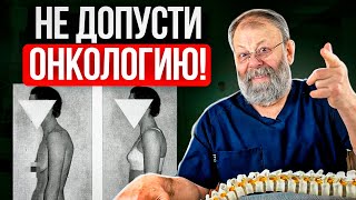 ОПУЩЕНИЕ И ОНКОЛОГИЯ! Как влияет на здоровье опущение внутренних органов?