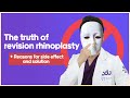 The truth of revision rhinoplasty + Reasons for side effect and solution