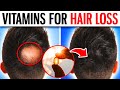 10 POWERFUL Vitamins That Prevent Hair Loss