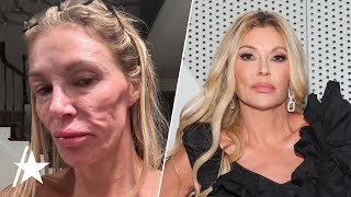 Brandi Glanville SHOCKS Fans With Unrecognizable Selfie Amid Health Struggles