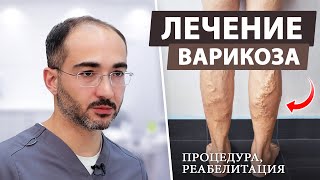 Варикоз на ногах: симптомы и эффективное лечение