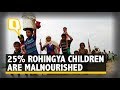 One out of Four Rohingya Children Are Suffering From Malnutrition | The Quint