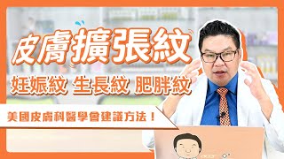 妊娠紋？生長紋？肥胖紋怎麼消除？擺脫「皮膚擴張紋」的秘訣！保養與預防攻略｜Dr.Hsieh達特醫