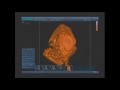 Ecografia 3D/4D Making 3D/4D ecography ultrasound SonoScape S11 Ecografia 3D/4D Making 3D/4D ecography ultrasound SonoScape S11