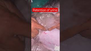 Retention of urine l dr Umar khan