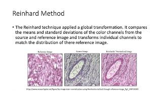 Evaluating the Impact of Color Normalization on Kidney Image Segmentation