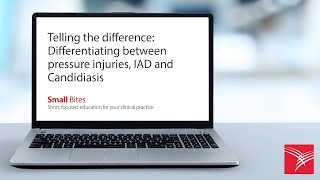 Telling the difference: Differentiating between pressure injuries, IAD and Candidiasis