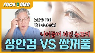 노화로 인해 처진 눈꼬리ㅠㅠ 상안검 vs 쌍꺼풀