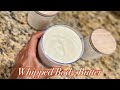 DIY WHIPPED BODY BUTTER  FOR ECZEMA, HYPERPIGMENTATION, ACNE SCARS, AND STRETCH MARKS