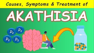 Akathisia by Antipsychotics - Causes, Symptoms and Treatments