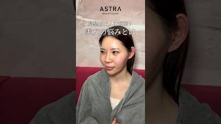 鼻整形で起こるメリット💖#astrabeautyclinic #アストラビューティクリニック #鼻整形 #整形ビフォーアフター #塩満恵子 #垢抜けたい女子 #忘れ鼻 #似合わせ鼻