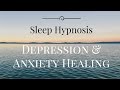 Sleep Hypnosis for Anxiety and Depression Healing