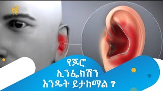 የጆሮ ኢንፌክሽን እንዴት ይታከማል ?