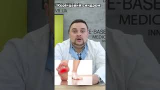 Корінцевий синдром