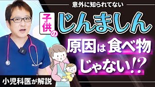 【小児科医が解説】意外に知られてない子供の「じんましん」の原因は食べ物じゃなかった！