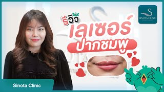 รีวิวเลเซอร์ปากชมพู ที่ Sinota Clinic แก้ปัญหาปากคล้ำกรรมพันธุ์