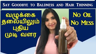 முடி உதிர்வை நிறுத்தி அடர்த்தியாக வளர செய்யும்  / Hair Growth Spray / Chennai Girl In London