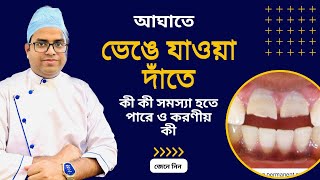 দাঁতে আঘাত লাগলে কী ক্ষতি হতে পারে ও করণীয় কী | broken teeth treatment | দাঁত ভেঙ্গে গেলে কি করবেন