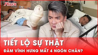 Tiết lộ sự thật về 4 ngón chân của Đàm Vĩnh Hưng | Hành trình phá án