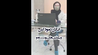 انگل دمودکس و بیماریهای پوست و مو