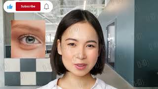 میدونی اگه صورتت این شش مشکل رو داشته باشه چی میشه؟ 6 things your face can tell you about your healt