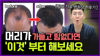 머리가 가늘어지는 이유 & 머리카락이 굵어지는 가장 확실한 방법