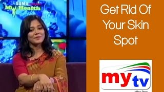 Dr. Tauhida Rahman Ereen | Get Rid Your Skin Spot | LIVE MY TV