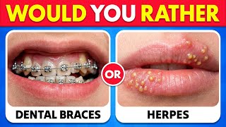 π₯ Would You Rather...? π¨ The 100 Most Extreme Choices Youβll EVER Face!