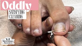 Satisfying Toenail Cleaning | Relaxing Silent Pedicure