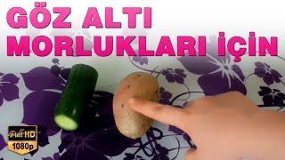 Göz Altı Morlukları İçin Pratik Bilgi: Salatalık ve Patates | Modanzi Cilt Bakımı