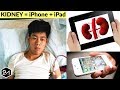 He Sold His Kidney For iPhone, But Got This In Return!